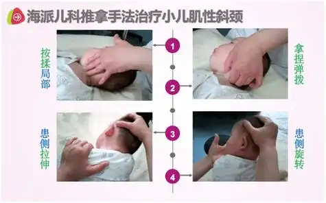如肌性斜颈宝宝治疗时,部分手法可能会让孩子酸痛而造成哭闹;又如姿势