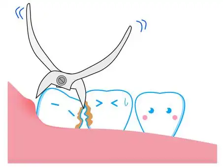 免费矢量剪贴画拔牙 |illustac